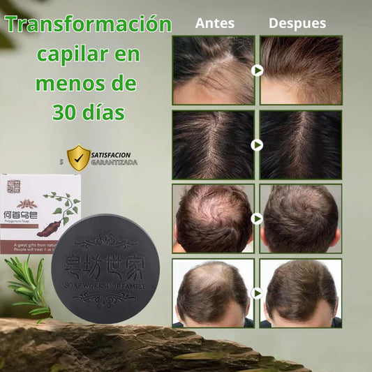 🌿HerbaDark – Shampoo Natural que Revitaliza, Crece y Ayuda a Oscurecer Canas